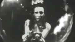 Cryptorchid